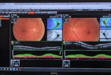 Photo of Orchids, retinas, stars, 9 December