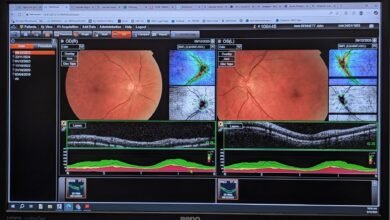 Photo of Orchids, retinas, stars, 9 December